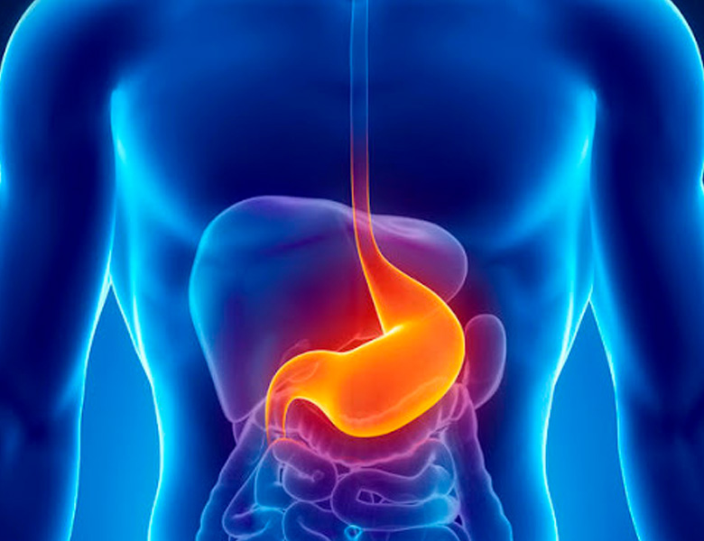 Cirurgia metabólica