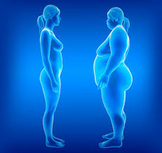 cirurgia bariátrica