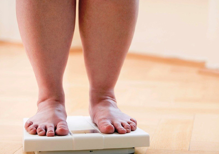 cirurgia bariátrica